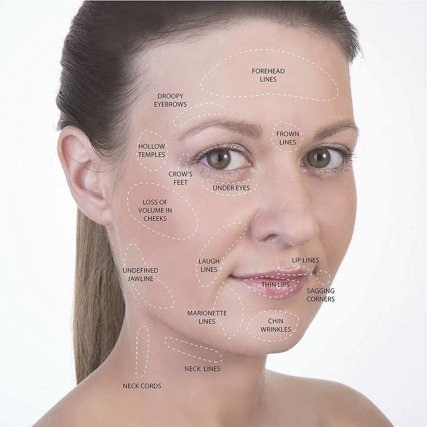 Conjunto De Ventosas Silicona Masaje Facial Corporal Ventosaterapia Cupping - Fresh Stock Dated February 2026